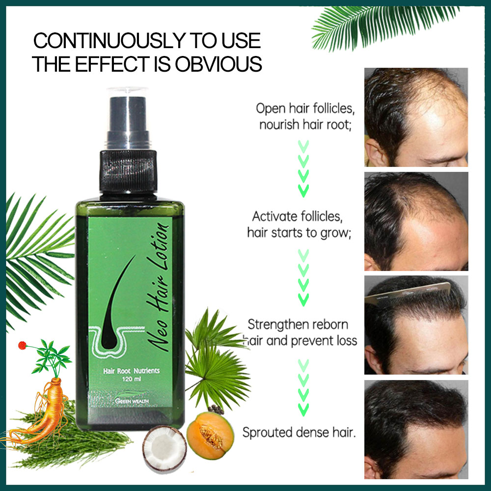 4 個ネオヘアローション 120 ミリリットルヘアケア毛根栄 - Nutrition And Fitness のレビューと価格